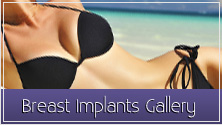 SkinCentre's Before and After Breast Implants Gallery