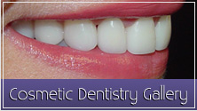 SkinCentre's Before anf After Cosmetic Dentistry Gallery