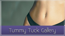 SkinCenter's Tummy Tuck Before and After Photos