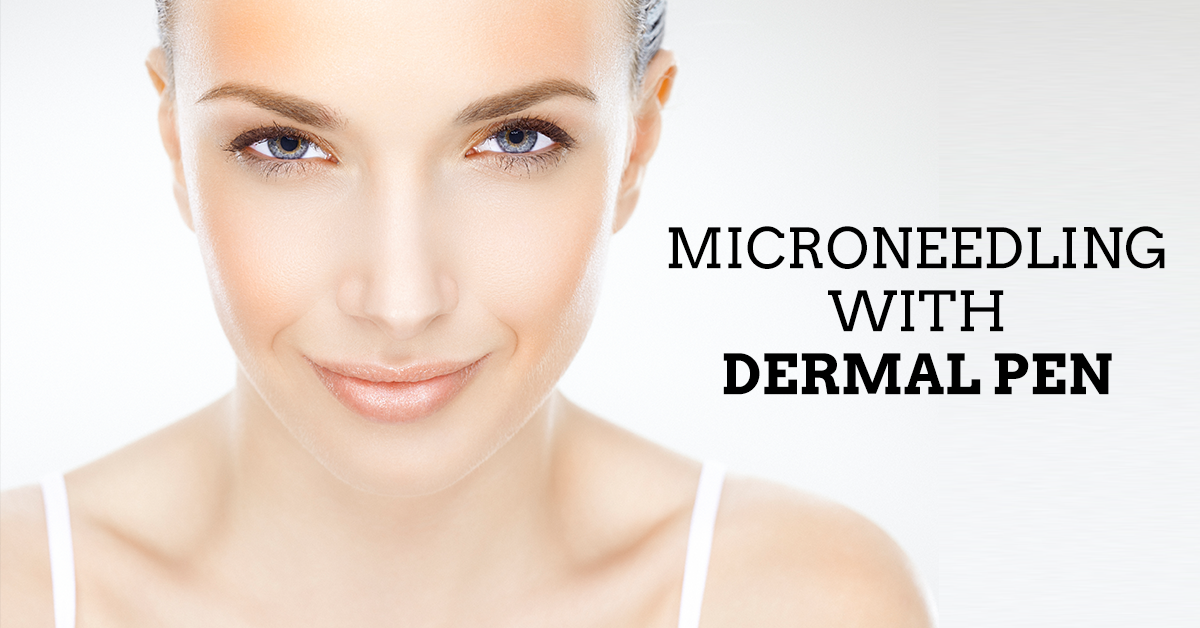 Say So Long to Wrinkles, Sun Damage & Acne Scars with Microneedling with DermaL Pen