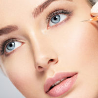 4 Facts About Preventative Botox
