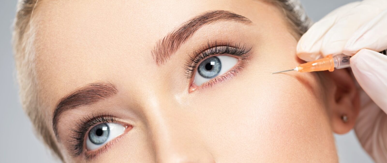 Botox vs Fillers: Which One Is Best at Treating Wrinkles?