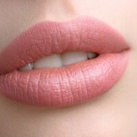 3 Top Dermal Fillers for a Youthful Mouth