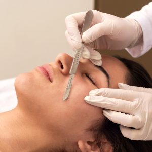 Dermaplaning procedure